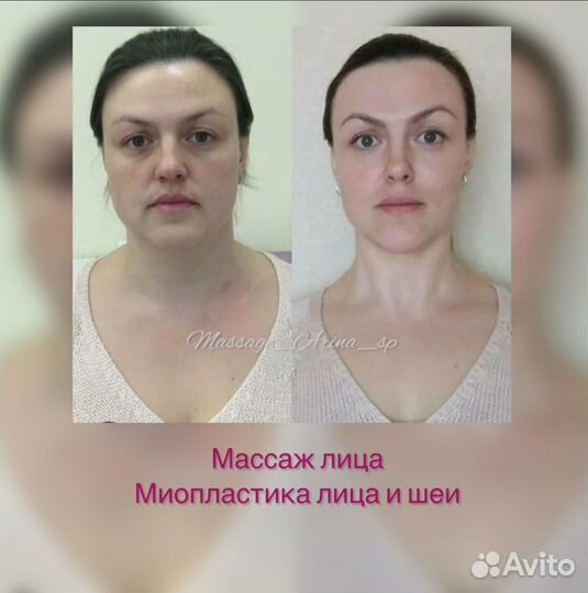 Массаж Лица/Тела.Липолитики.Обертывание