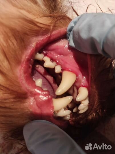 Ультрозвуковая чистка зубов