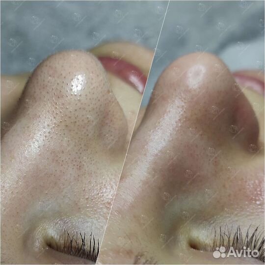 Массаж и чистка лица