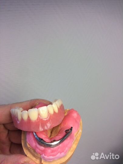 Съёмные зубные протезы