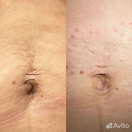 Услуги косметолога