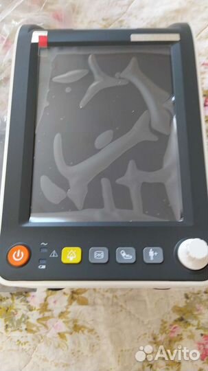 Монитор анестезиологический