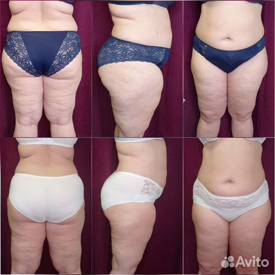 Шугаринг сахарное моделирование