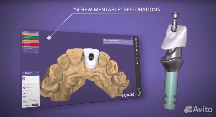 ExoCad 3.2 Elefsina Самая актуальная версия