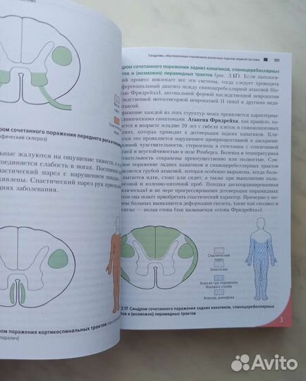 Топический диагноз в неврологии по Петеру Дуусу