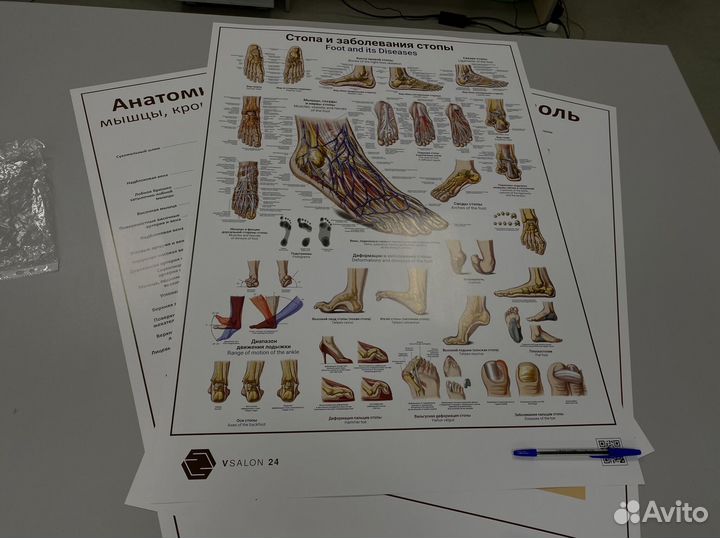Плакат стопа и заболевания стопы