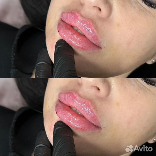 Услуги косметолога