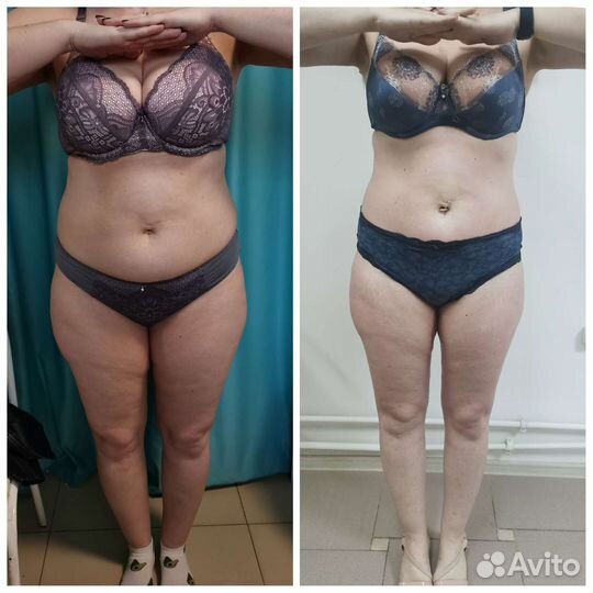 Аппаратный массаж, Вибромассаж, Вакуумный, Лифтинг