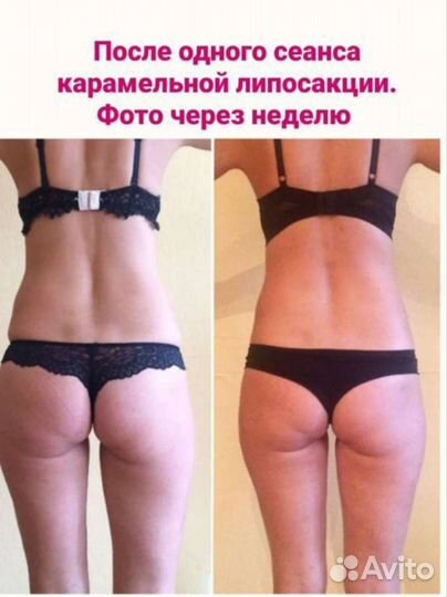 Массаж / кавитация / липосакция / массаж лица