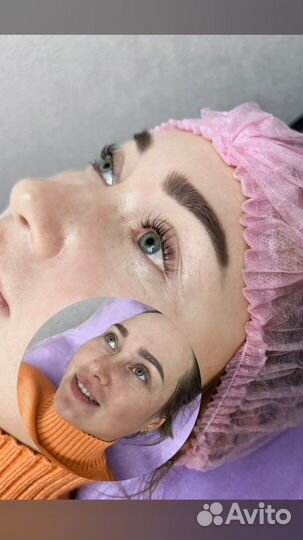 Стрейчинг ресниц