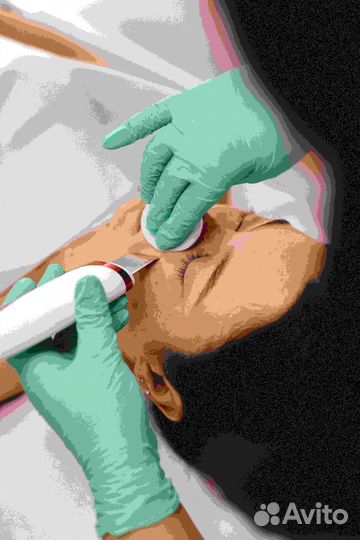 Франшиза лазерной эпиляции #LaserLove