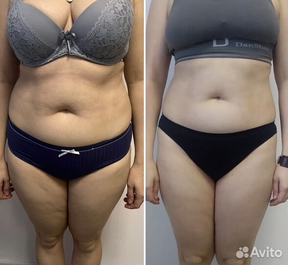 Коррекция фигуры