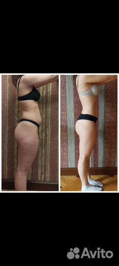 Антицеллюлитный массаж. Общий массаж