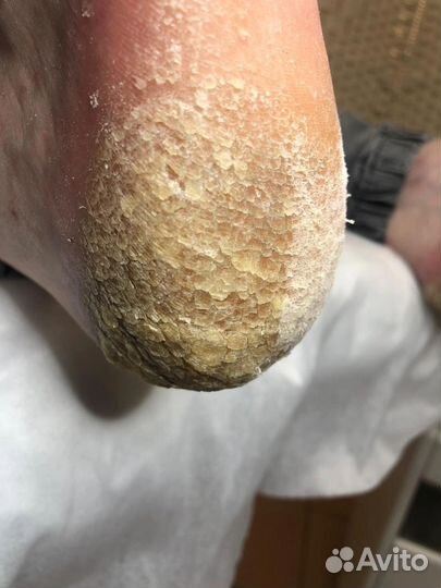 Педикюр с выездом на дом