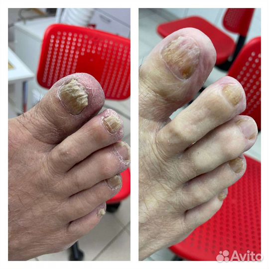 Услуги подолога