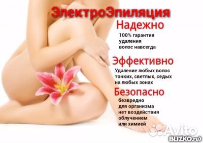 Электроэпиляция