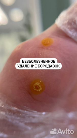 Подолог / Подология