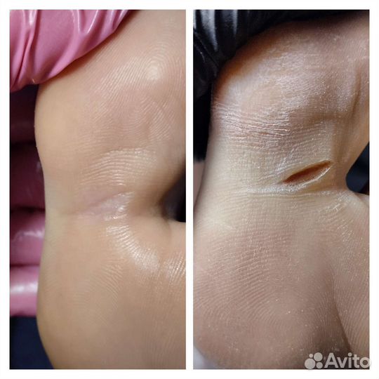 Педикюр/маникюр с выездом на дом любой сложности