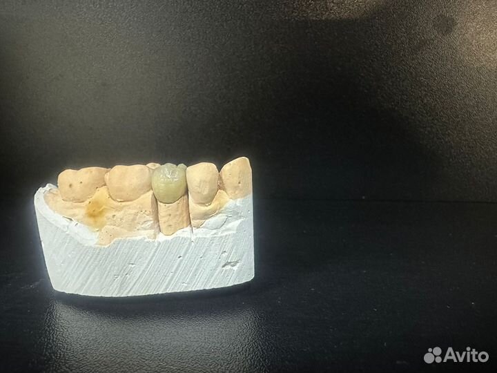 Услуги зубного техника