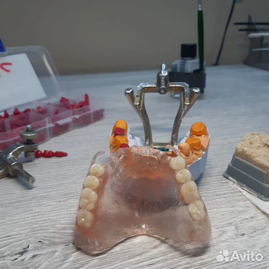 Зубные протезы