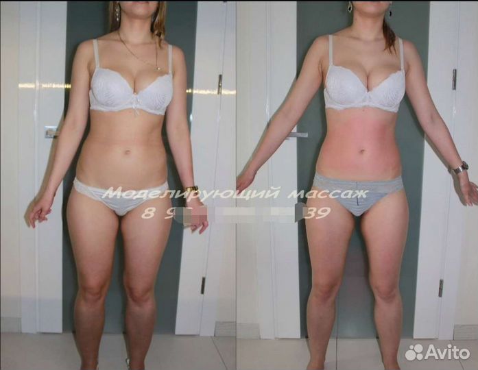 Моделирующий массаж - 2 размера за курс