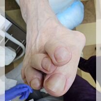 Подолог с медицинским образованием. Выезд на дом, Орёл