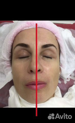 Скульптурный массаж лица