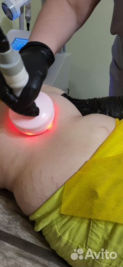 Срочное похудение