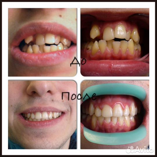 Врач стоматолог ортодонт