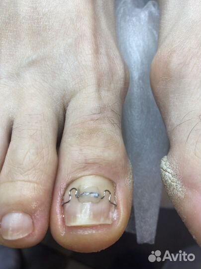 Ортониксия