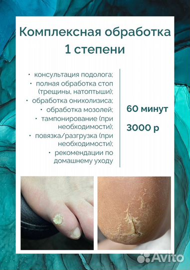 Педикюр подолог Омск Амур