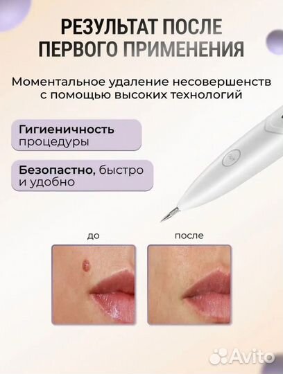 Лазерная ручка для удаления папиллом