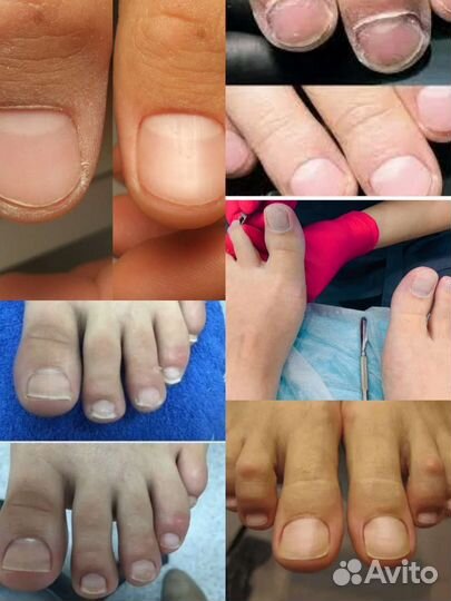 Аппаратный маникюр