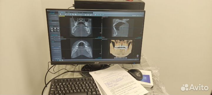 Ремонт/Монтаж рентген аппарата(Vatech,MyRay,Sirona