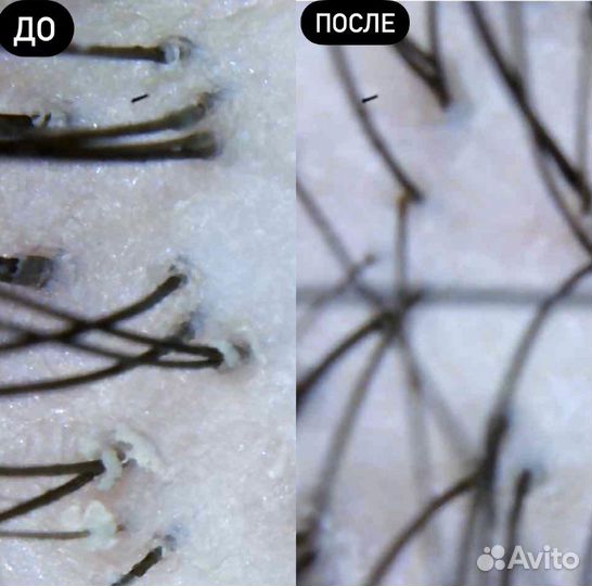 Кератиновое выпрямление/ботокс/женские стрижки