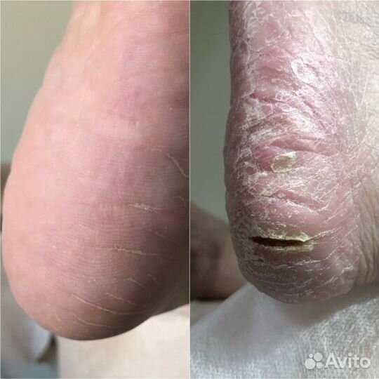 Кабинет педикюра, подолог Лобня