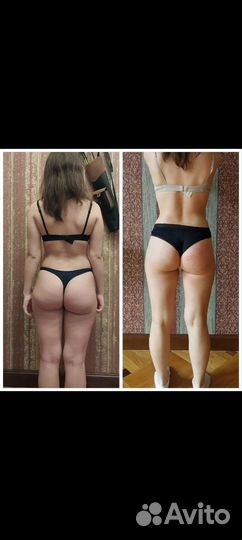 Антицеллюлитный массаж. Общий массаж