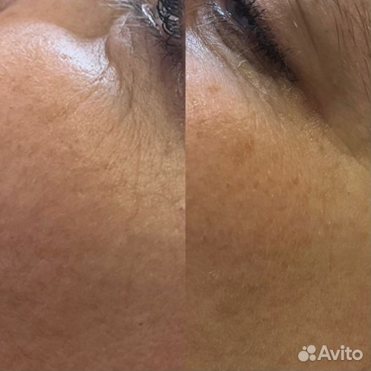 Обучение косметик-эстетист