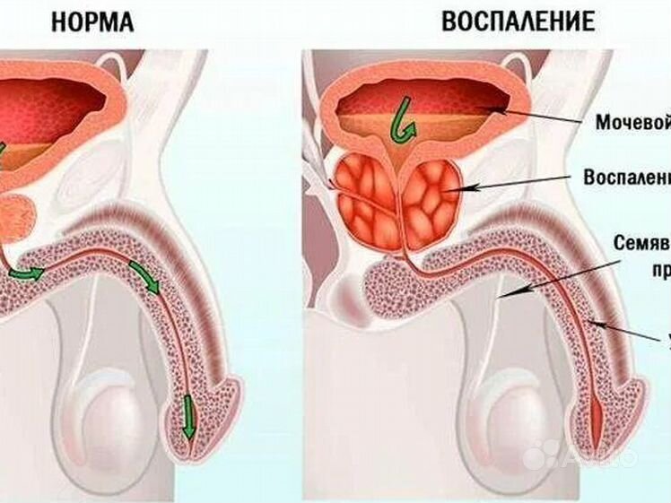 Массаж простаты от проституток