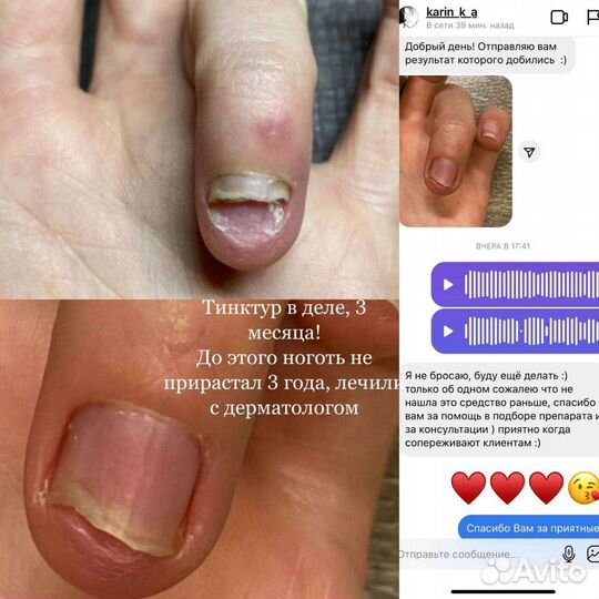 Педикюр Подология Бесплатно консультация