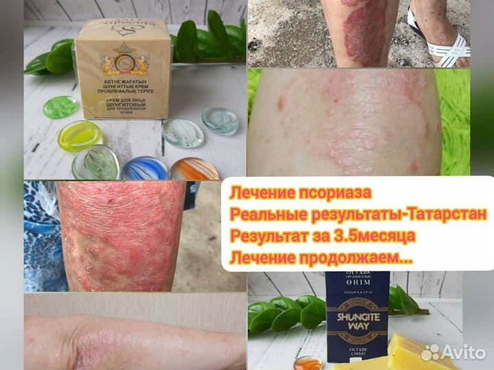 Шунгитовое мыло