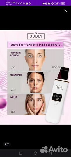 Ультразвуковой аппарат для чистки лица