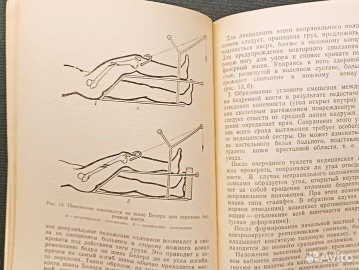 Уход за больными в травматологическом стационаре