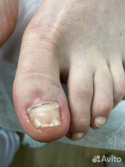 Подология, маникюр - педикюр