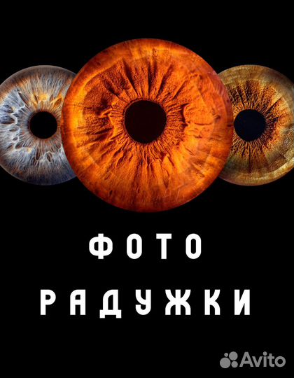 Фото вашей радужки