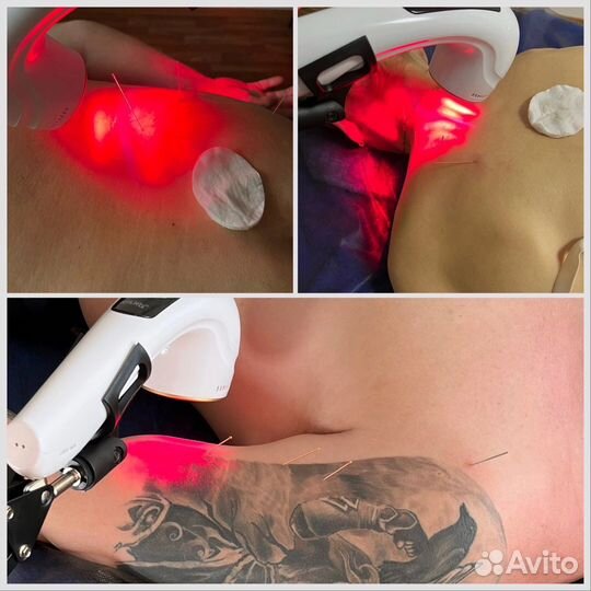 Мануальные техники, Массаж, Реабилитация