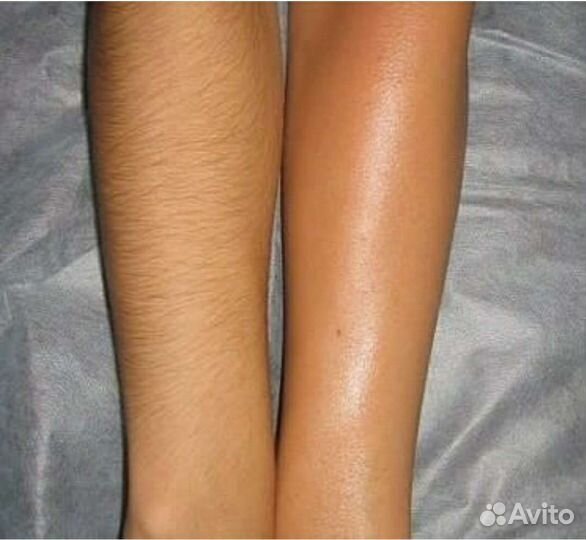 SPA-шугаринг/ваксинг