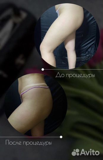 Моментальный загар