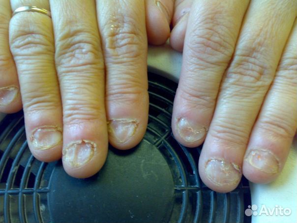 Наращивание ногтей