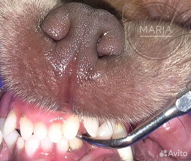 Ультразвуковая чистка зубов без стресса